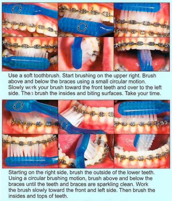 brushing1