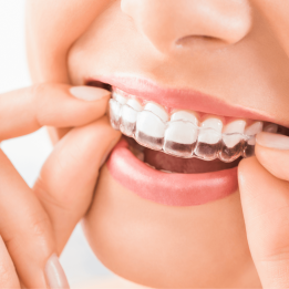 invisalign